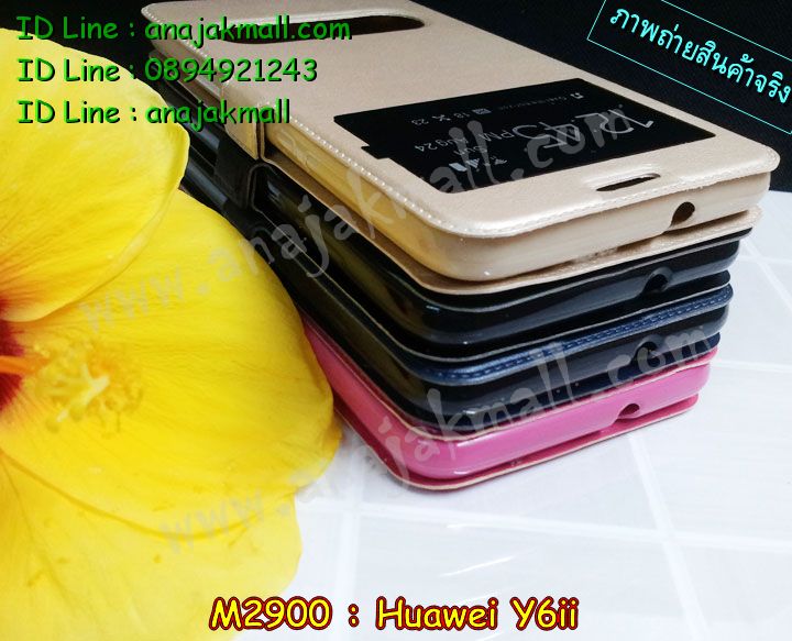 เคส Huawei y6ii,เคสสกรีนหัวเหว่ย y6 ii,รับพิมพ์ลายเคส Huawei y6 ii,เคสหนัง Huawei y6 ii,เคสไดอารี่ Huawei y6 ii,สั่งสกรีนเคส Huawei y6 ii,เคสโรบอทหัวเหว่ย y6 ii,เคสแข็งหรูหัวเหว่ย y6 ii,เคสโชว์เบอร์หัวเหว่ย y6 ii,เคสสกรีน 3 มิติหัวเหว่ย y6 ii,ซองหนังเคสหัวเหว่ย y6 ii,สกรีนเคสนูน 3 มิติ Huawei y6 ii,เคสอลูมิเนียมสกรีนลายนูน 3 มิติ,เคสพิมพ์ลาย Huawei y6 ii,เคสฝาพับ Huawei y6 ii,เคสหนังประดับ Huawei y6 ii,เคสแข็งประดับ Huawei y6 ii,เคสตัวการ์ตูน Huawei y6 ii,เครสกันกระแทก Huawei y6ii,เคสซิลิโคนเด็ก Huawei y6 ii,เคสสกรีนลาย Huawei y6 ii,เคสลายนูน 3D Huawei y6 ii,รับทำลายเคสตามสั่ง Huawei y6 ii,เคสกันกระแทก Huawei y6 ii,เคส 2 ชั้น กันกระแทก Huawei y6 ii,เคสบุหนังอลูมิเนียมหัวเหว่ย y6 ii,กรอบกันกระแทก Huawei y6ii,สั่งพิมพ์ลายเคส Huawei y6 ii,เคสอลูมิเนียมสกรีนลายหัวเหว่ย y6 ii,บัมเปอร์เคสหัวเหว่ย y6 ii,บัมเปอร์ลายการ์ตูนหัวเหว่ย y6 ii,เคสยางนูน 3 มิติ Huawei y6 ii,พิมพ์ลายเคสนูน Huawei y6 ii,เคสยางใส Huawei y6 ii,เคสโชว์เบอร์หัวเหว่ย y6 ii,สกรีนเคสยางหัวเหว่ย y6 ii,พิมพ์เคสยางการ์ตูนหัวเหว่ย y6 ii,ทำลายเคสหัวเหว่ย y6 ii,ฝากันกระแทก Huawei y6ii,เครสกันลาย Huawei y6ii,กรอบยาง Huawei y6ii,เคสยางหูกระต่าย Huawei y6 ii,เคสอลูมิเนียม Huawei y6 ii,เคสอลูมิเนียมสกรีนลาย Huawei y6 ii,เคสแข็งลายการ์ตูน Huawei y6 ii,เคสนิ่มพิมพ์ลาย Huawei y6 ii,เคสซิลิโคน Huawei y6 ii,เคสยางฝาพับหัวเว่ย y6 ii,เคสยางมีหู Huawei y6 ii,เคสประดับ Huawei y6 ii,เคสปั้มเปอร์ Huawei y6 ii,เคสตกแต่งเพชร Huawei y6 ii,เคสขอบอลูมิเนียมหัวเหว่ย y6 ii,เคสแข็งคริสตัล Huawei y6 ii,เคสฟรุ้งฟริ้ง Huawei y6 ii,เคสฝาพับคริสตัล Huawei y6 ii
